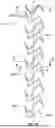 Fig. 20 - ROBOTIC SYSTEMS FOR DELIVERING ENDOBRONCHIAL IMPLANTS AND RELATED TECHNOLOGY