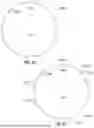 Fig. 22 - ROBOTIC SYSTEMS FOR DELIVERING ENDOBRONCHIAL IMPLANTS AND RELATED TECHNOLOGY