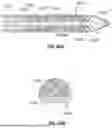 Fig. 47 - ROBOTIC SYSTEMS FOR DELIVERING ENDOBRONCHIAL IMPLANTS AND RELATED TECHNOLOGY