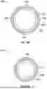 Fig. 52 - ROBOTIC SYSTEMS FOR DELIVERING ENDOBRONCHIAL IMPLANTS AND RELATED TECHNOLOGY