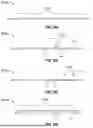 Fig. 67 - ROBOTIC SYSTEMS FOR DELIVERING ENDOBRONCHIAL IMPLANTS AND RELATED TECHNOLOGY