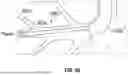 Fig. 68 - ROBOTIC SYSTEMS FOR DELIVERING ENDOBRONCHIAL IMPLANTS AND RELATED TECHNOLOGY