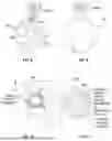 Fig. 08 - METHODS AND SYSTEMS FOR TREATING PULMONARY DISEASE