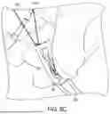 Fig. 07 - GRAFT PREPARATION SYSTEM