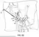 Fig. 08 - GRAFT PREPARATION SYSTEM