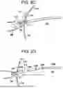 Fig. 05 - SYSTEMS AND METHODS FOR LIGAMENT GRAFT PREPARATION