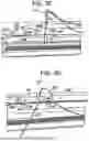 Fig. 07 - SYSTEMS AND METHODS FOR LIGAMENT GRAFT PREPARATION