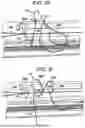Fig. 08 - SYSTEMS AND METHODS FOR LIGAMENT GRAFT PREPARATION