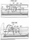Fig. 09 - SYSTEMS AND METHODS FOR LIGAMENT GRAFT PREPARATION