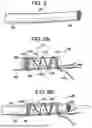 Fig. 12 - SYSTEMS AND METHODS FOR LIGAMENT GRAFT PREPARATION
