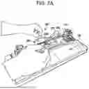 Fig. 14 - SYSTEMS AND METHODS FOR LIGAMENT GRAFT PREPARATION