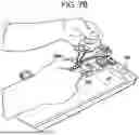 Fig. 15 - SYSTEMS AND METHODS FOR LIGAMENT GRAFT PREPARATION