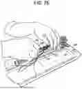 Fig. 18 - SYSTEMS AND METHODS FOR LIGAMENT GRAFT PREPARATION