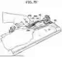 Fig. 19 - SYSTEMS AND METHODS FOR LIGAMENT GRAFT PREPARATION