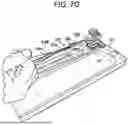 Fig. 20 - SYSTEMS AND METHODS FOR LIGAMENT GRAFT PREPARATION