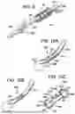 Fig. 23 - SYSTEMS AND METHODS FOR LIGAMENT GRAFT PREPARATION
