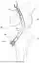 Fig. 01 - LIGAMENT FIXATION DEVICE AND METHOD