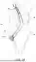 Fig. 06 - LIGAMENT FIXATION DEVICE AND METHOD