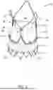 Fig. 02 - REPLACEMENT HEART VALVE IMPLANT