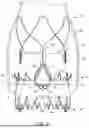 Fig. 06 - REPLACEMENT HEART VALVE IMPLANT