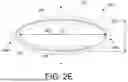 Fig. 05 - PROSTHETIC VALVES AND OVAL STENTS FOR FLOW BALANCING
