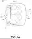 Fig. 08 - PROSTHETIC VALVES AND OVAL STENTS FOR FLOW BALANCING