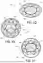 Fig. 10 - PROSTHETIC VALVES AND OVAL STENTS FOR FLOW BALANCING