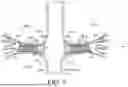 Fig. 11 - PROSTHETIC VALVES AND OVAL STENTS FOR FLOW BALANCING