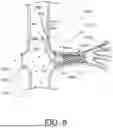 Fig. 12 - PROSTHETIC VALVES AND OVAL STENTS FOR FLOW BALANCING