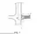 Fig. 13 - PROSTHETIC VALVES AND OVAL STENTS FOR FLOW BALANCING