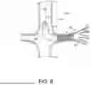 Fig. 14 - PROSTHETIC VALVES AND OVAL STENTS FOR FLOW BALANCING
