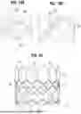 Fig. 07 - PROSTHETIC HEART VALVE