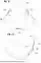 Fig. 09 - PROSTHETIC HEART VALVE
