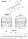 Fig. 15 - PROSTHETIC HEART VALVE