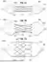 Fig. 27 - PROSTHETIC HEART VALVE