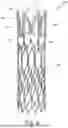 Fig. 05 - ANTENNAE FOR STENT AND HEART VALVES