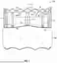Fig. 02 - PROSTHETIC HEART VALVE