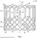 Fig. 03 - PROSTHETIC HEART VALVE