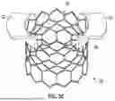 Fig. 04 - SYSTEMS, DEVICES, AND METHODS FOR TREATING HEART VALVES