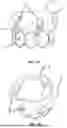 Fig. 12 - SYSTEMS, DEVICES, AND METHODS FOR TREATING HEART VALVES