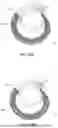 Fig. 22 - SYSTEMS, DEVICES, AND METHODS FOR TREATING HEART VALVES
