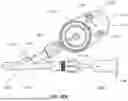 Fig. 42 - SYSTEMS, DEVICES, AND METHODS FOR TREATING HEART VALVES