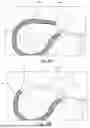 Fig. 52 - SYSTEMS, DEVICES, AND METHODS FOR TREATING HEART VALVES