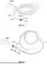 Fig. 54 - SYSTEMS, DEVICES, AND METHODS FOR TREATING HEART VALVES