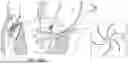 Fig. 11 - ATRIOVENTRICULAR VALVE REPAIR