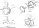 Fig. 04 - APPARATUS AND METHODS FOR TREATING A DEFECTIVE CARDIAC VALVE