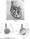 Fig. 06 - APPARATUS AND METHODS FOR TREATING A DEFECTIVE CARDIAC VALVE