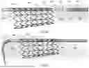 Fig. 10 - APPARATUS AND METHODS FOR TREATING A DEFECTIVE CARDIAC VALVE