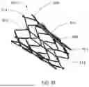 Fig. 13 - APPARATUS AND METHODS FOR TREATING A DEFECTIVE CARDIAC VALVE