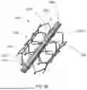 Fig. 15 - APPARATUS AND METHODS FOR TREATING A DEFECTIVE CARDIAC VALVE